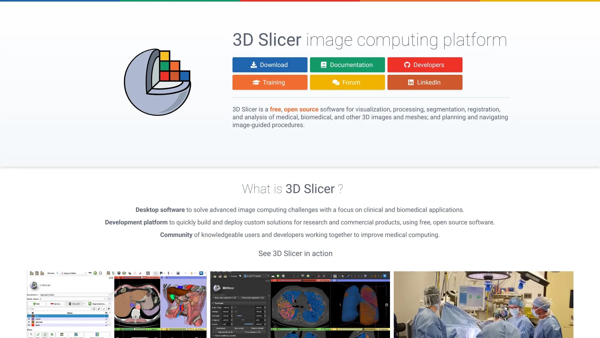 3D Slicer